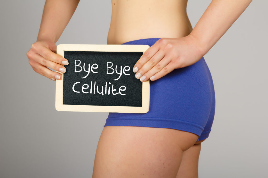 cellulite