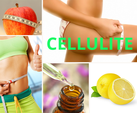 Cellulite - 580 x 480