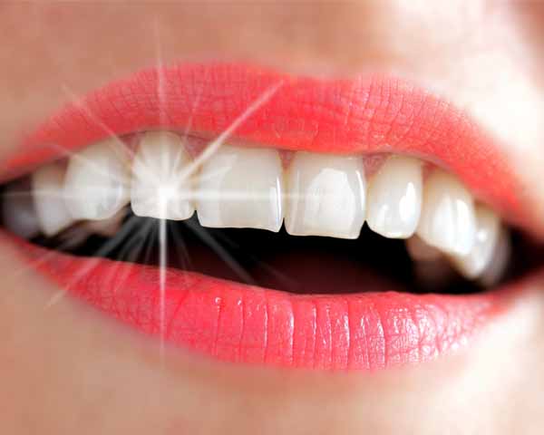 Dents blanches 600 x 480